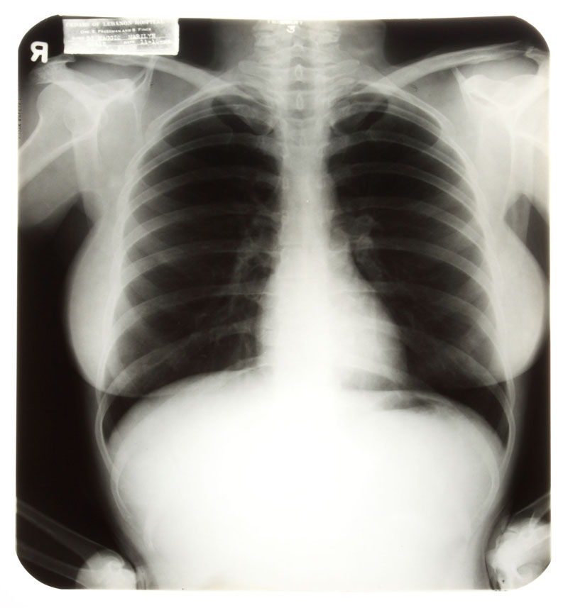 Illustration for article titled X-Ray Console Quiz!
